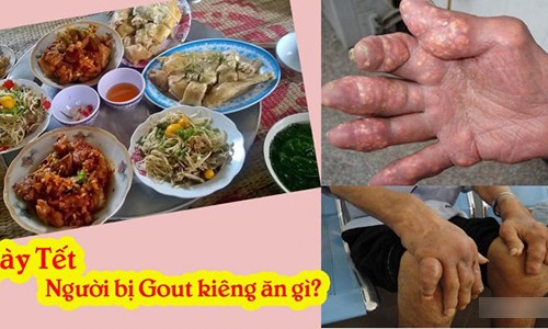 Ngày Tết, người bị gout phải kiêng ăn gì?