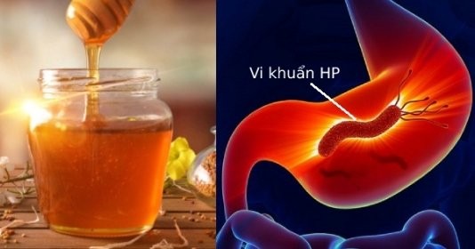 8 thực phẩm triệt hạ vi khuẩn HP trong dạ dày