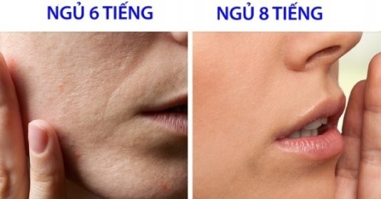 Những thói quen khiến phụ nữ nhanh già, da đầy mụn và nếp nhăn