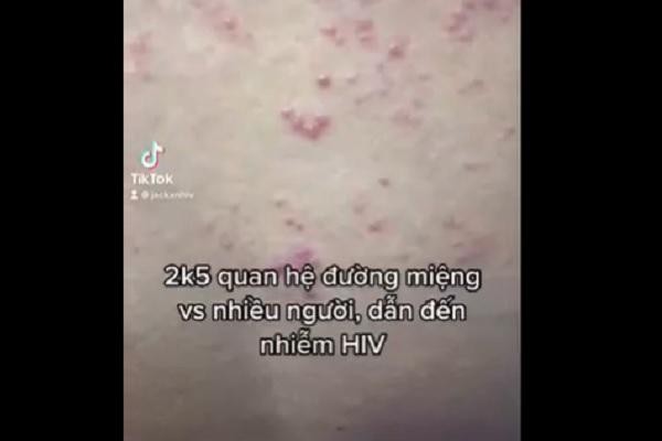 Nam sinh 16 tuổi suy sụp khi nhiễm HIV vì 1 kiểu quan hệ tình dục