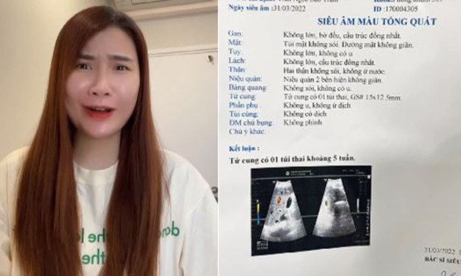 'Hot face' Thanh Trần mang bầu lần ba