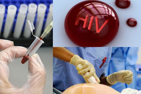 Những vụ công an, bác sĩ phơi nhiễm HIV kinh hoàng nhất VN