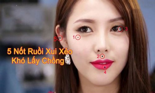 Video: Những nốt ruồi “ám quẻ” nên xóa nếu không muốn gánh họa cả đời