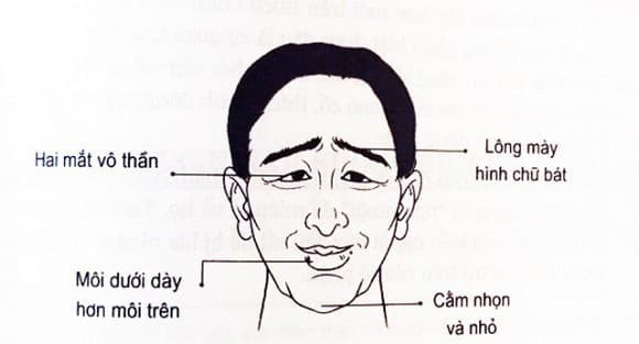 Đàn ông sở hữu 3 nét tướng này đoản thọ, cả đời nghèo khổ 