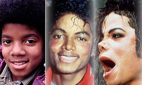 Hành trình 25 năm "dao kéo" của vua pop Michael Jackson