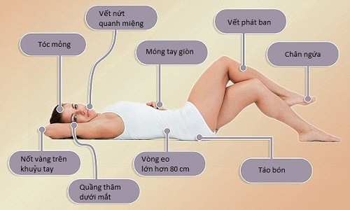 9 dấu vết xấu xí trên cơ thể chứng tỏ bạn có bệnh 