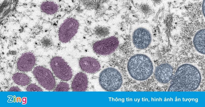 WHO: Hơn 3.400 ca mắc đậu mùa khỉ, một người tử vong