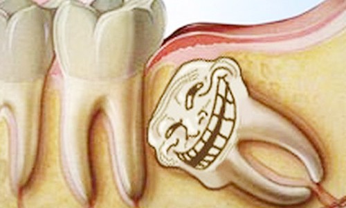 7 bộ phận cơ thể thừa thãi nhưng vẫn tồn tại