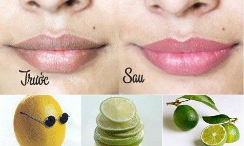 Môi hồng sau 1 đêm với 4 công thức đơn giản