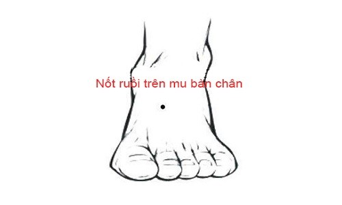 Nốt ruồi trên bàn chân nói lên điều gì? 