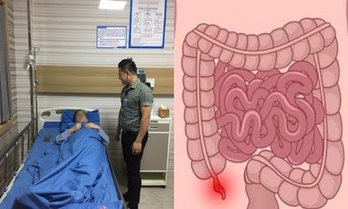 Cứu sống một bệnh nhân người nước ngoài vỡ ruột thừa nguy kịch