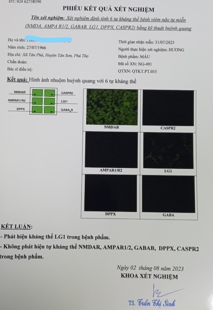 Kết quả xét nghiệm viêm não tự miễn