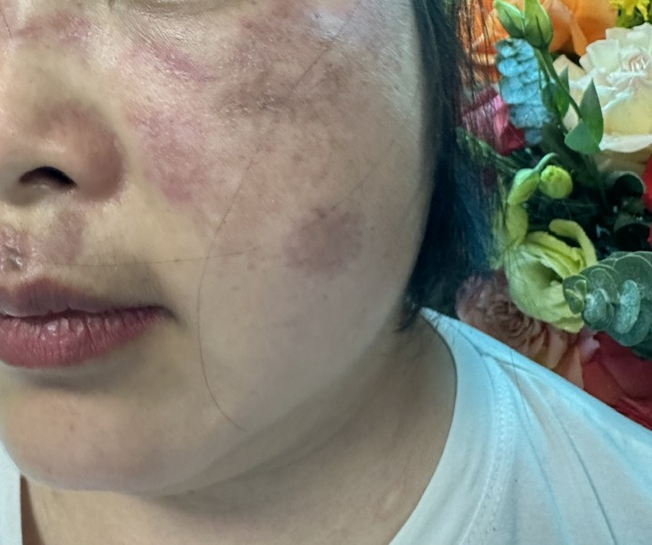 Địa chỉ vàng: Bệnh viện có khả năng chẩn đoán bệnh Lupus ban đỏ ảnh 2