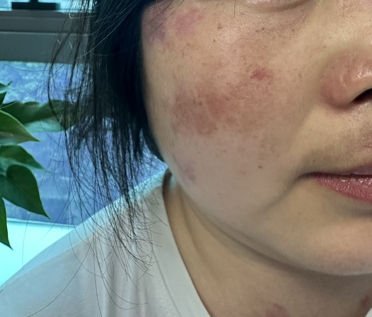 Địa chỉ vàng: Bệnh viện có khả năng chẩn đoán bệnh Lupus ban đỏ ảnh 1