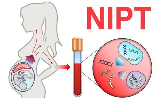 Xét nghiệm NIPT, Double Test, Triple Test chẩn đoán dị tật thai nhi xn-nipt.jpg