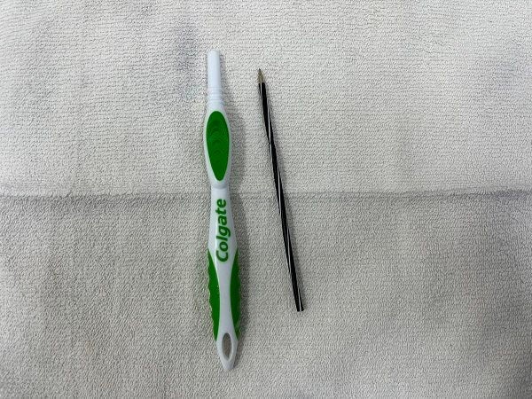 Dị vật bàn chải đánh răng và bút bi được lấy ra ban-chai-danh-rang.jpg