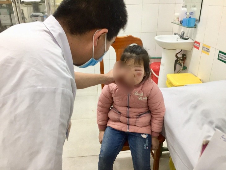 Cao Bằng: Bé 6 tuổi suýt mù mắt vì rửa lá trần không la-trau-khong.jpg