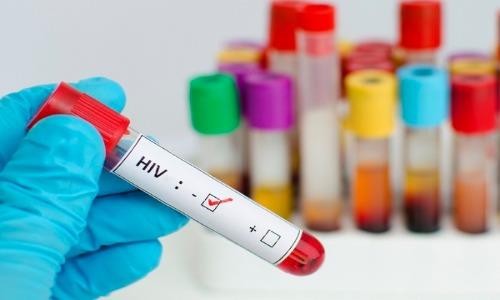 Cưỡng dâm truyền bệnh HIV, xử phạt ra sao?