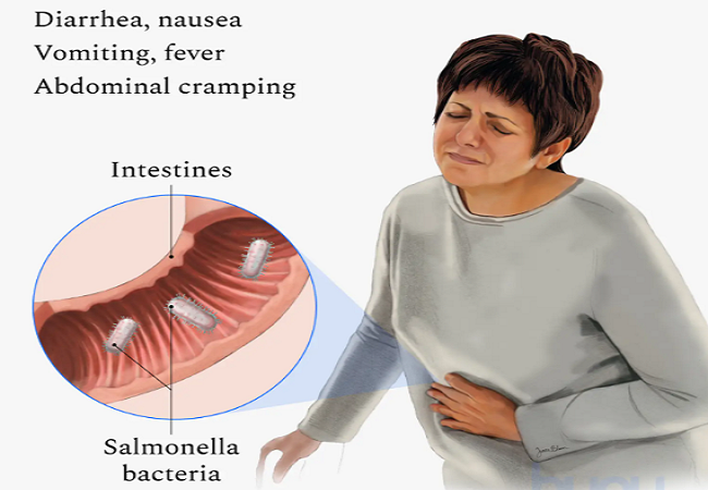 Triệu chứng nhiễm khuẩn Salmonella dễ nhầm lẫn