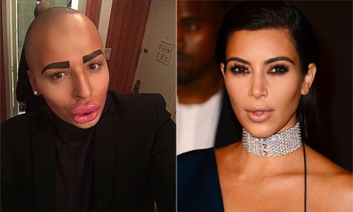 Fan cuồng Kim Kardashian phá nát khuôn mặt để giống thần tượng