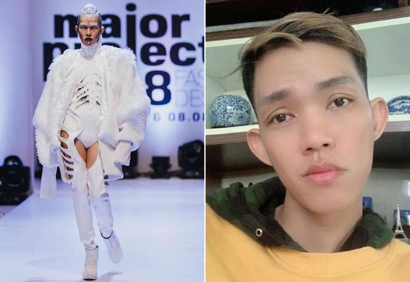 Viêm tụy cấp nguy hiểm thế nào... Hoàng Ân Next Top Model qua đời?