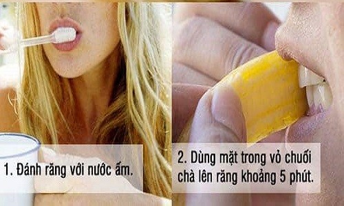 Mẹo hay lấy cao răng bằng vỏ chuối