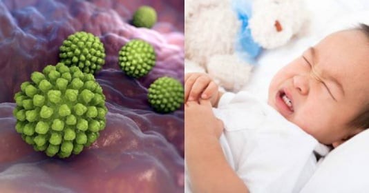 Virus Rota tấn công trẻ em toàn thế giới: BS chỉ ra 8 triệu chứng