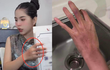 Hằng Du Mục lên livestream với gương mặt bầm tím, netizen lo lắng