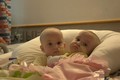Phẫu thuật thành công tách 2 bé gái sinh đôi dính liền tại Philadelphia