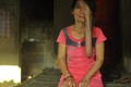 Người đàn bà 50 năm cô đơn cùng “gương mặt quỷ“