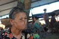 40 năm vác “cục khổ” trên mặt,cụ bà mong 1 bữa ngon