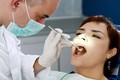Khi nào nên đi lấy cao răng?