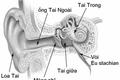 Cẩn trọng bệnh viêm tai giữa cấp