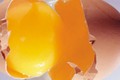 Trứng gà hỗ trợ điều trị thiếu máu