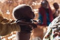 Loạt ảnh gây sốc về những đứa trẻ suy dinh dưỡng ở Nigeria
