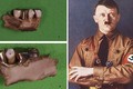 Sự thật sốc về trùm phát xít Hitler qua bí mật trong hàm răng