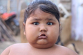  Cuộc sống bất thường của bé gái nặng nhất Ấn Độ