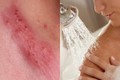 3 mẹ con nhiễm HPV, nguyên nhân vì vật thường dùng trong nhà tắm