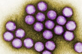 6 trẻ tử vong do virus Adeno: Biến chứng nguy hiểm sao?