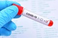 Cảnh báo về biến thể làm tăng nguy cơ bùng phát đợt dịch COVID-19 mới