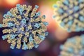 Virus sởi đột biến liên quan đến bệnh viêm não gây tử vong