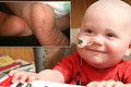 Ngắm bé ung thư 2 tuổi siêu “cute“