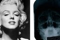 Lộ bằng chứng Marilyn Monroe phẫu thuật thẩm mỹ