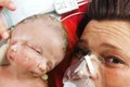 Thương tâm bé sơ sinh có 2 mặt trên một đầu