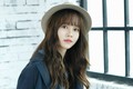 Kim So Hyun bất ngờ bị thương tại trường quay