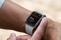 Apple Watch phát hiện COVID-19 có “đá văng” Samsung, Huawei?