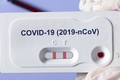 Công nghệ sinh quang học mới phát hiện nhanh COVID-19: Hiệu quả sao? 