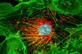 Điểm mặt các loại virus gây ung thư đáng sợ (P2)