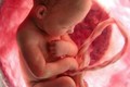 Ăn nhau thai của mình để tránh trầm cảm sau sinh