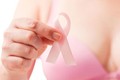 Trường hợp nào không nên hóa trị ung thư vú?